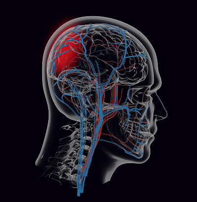 Neurosurgery
